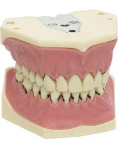 Parodontologiemodell A-PZ St