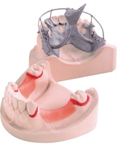 OCTA-Stone M pink Pa 4x5kg
