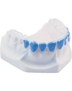 BIOPLAST bleach 1,0x125mm rund