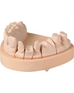 OCTA-Stone CN champagner Pa 4x5kg