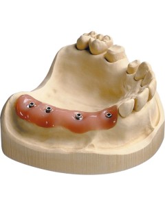Implant-Mask scan+15ml Trennmittel