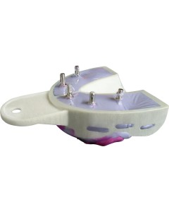 Miratray Implant Abdrucklöffel