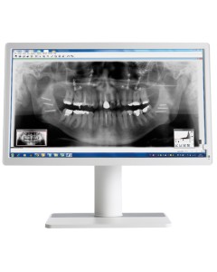 Befundungsmonitor Barco MDNC-2123DEWH     999,00 €