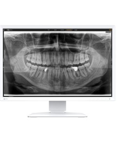 EIZO Befundungsmonitor MX243W-DT RadiForce - Raumklasse 5 und 6
