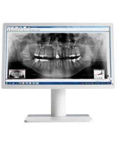 Befundungsmonitor Barco MDNC-2123DEWH     999,00 €
