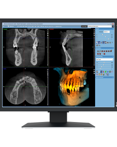 EIZO MX217-SB Befundungsmonitor Dental